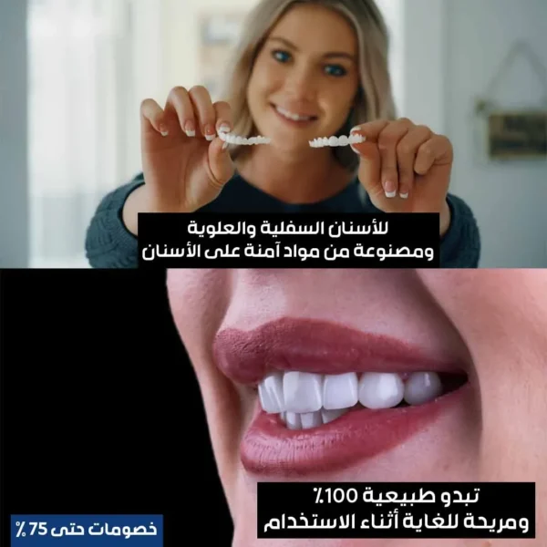 Hollywood Smile Teeth - Image 4
