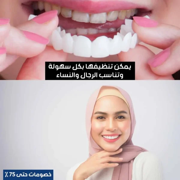 Hollywood Smile Teeth - Image 3